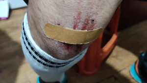 好医保赔足球受伤吗？一文带你了解相关赔付情况