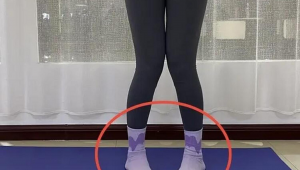 膝外翻适合踢足球吗?探究膝外翻人群在足球运动中的可行性