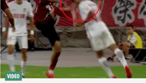 被足球爆头问题大吗？关乎安全需重视足球运动潜在风险