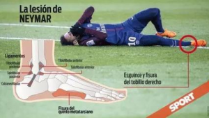 穿足球鞋踢足球就不会痛？真相究竟如何