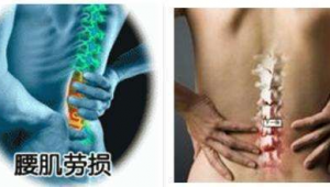 腰肌劳损对踢足球有无影响？答案在这里！