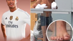 脚趾穿足球变形后，究竟还能不能恢复原状？