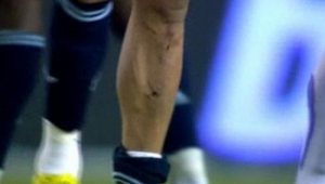 女生练足球是否要带护腿板?这些要点告诉你答案