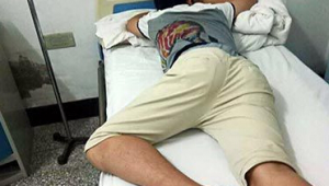 踢足球会导致痔疮出血吗