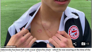 足球场上能佩戴项链吗？女生在足球运动中可以戴项链吗