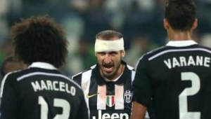 足球脸流血不让医生碰吗