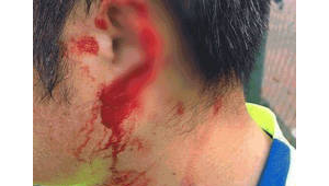 踢足球耳朵漏风正常吗？探究其背后的原因与真相