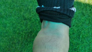 踢足球脚踝痛正常吗？是受伤信号还是运动常态？