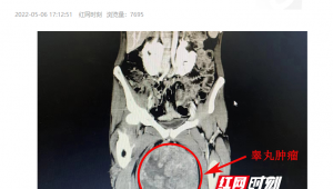 足球真的能伤睾丸吗