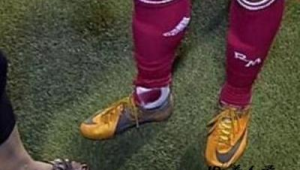 足球钉鞋踩到人究竟有多疼？真相让人意想不到