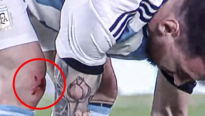 足球场受伤会流血吗？探索足球场上那些潜在的伤痛与风险